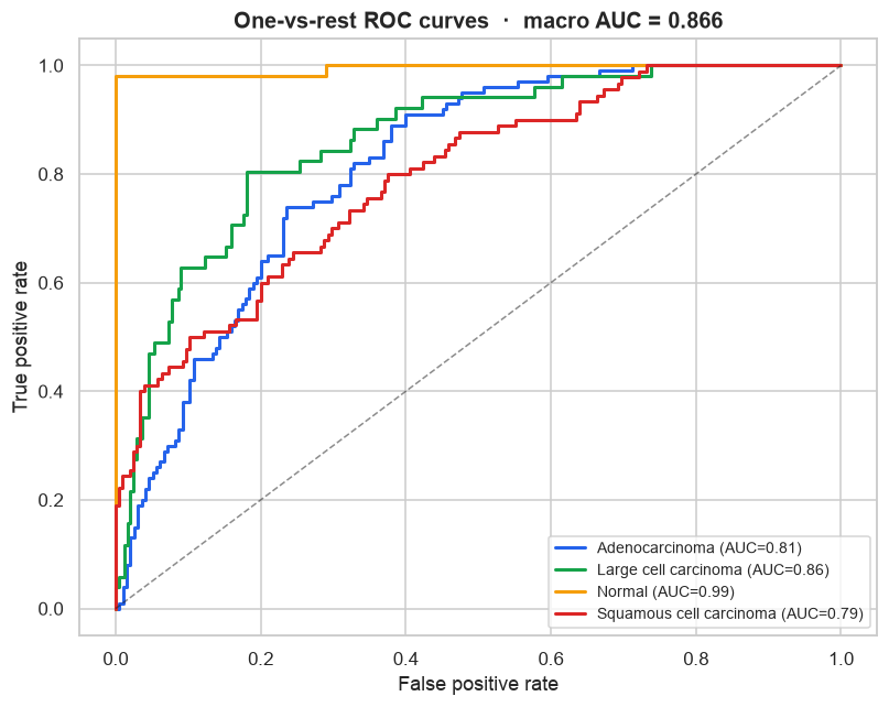 One-vs-rest ROC curves.