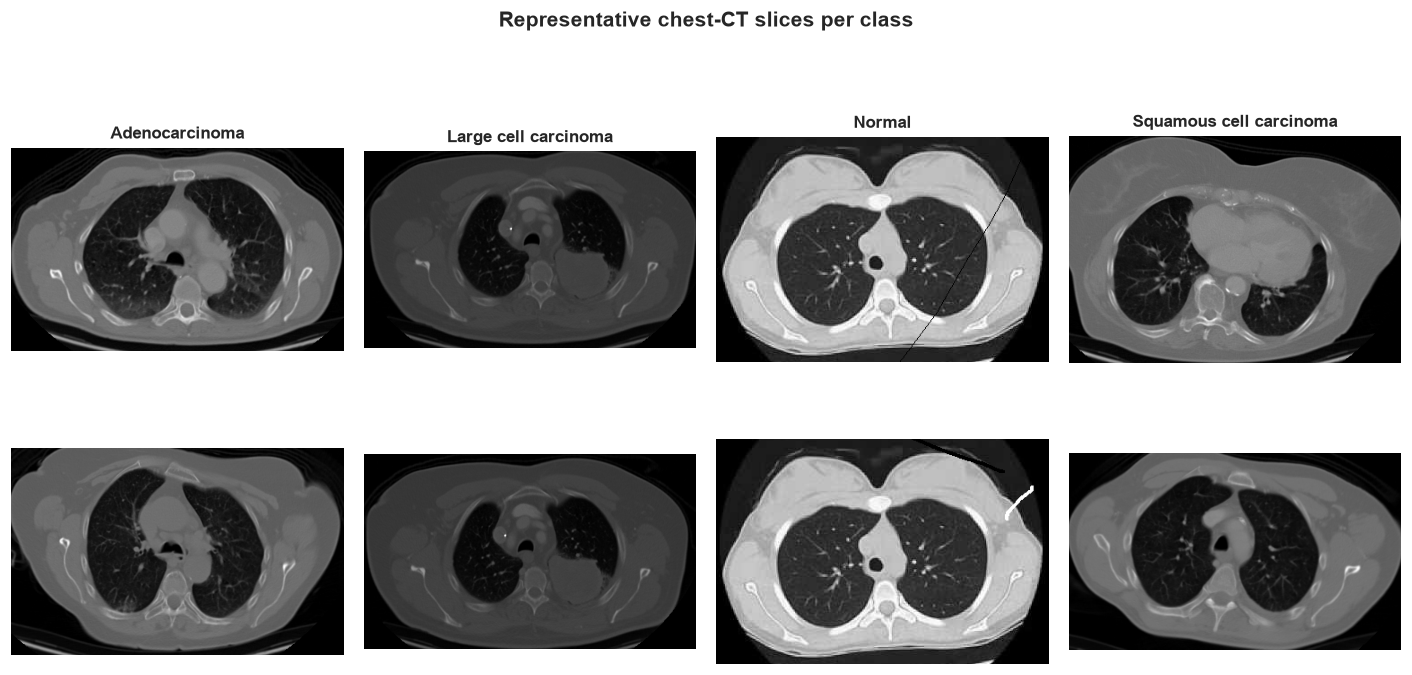 Representative chest-CT slices for each class.